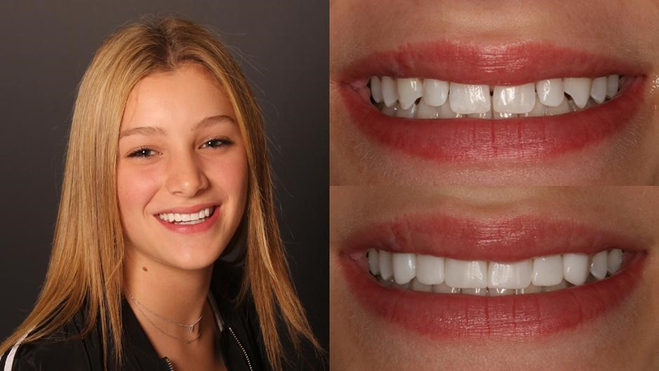 Best Cosmetic Dentist In Chicago