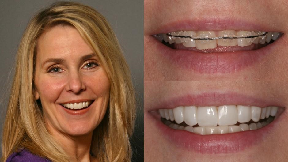 Best Cosmetic Dentist In Chicago