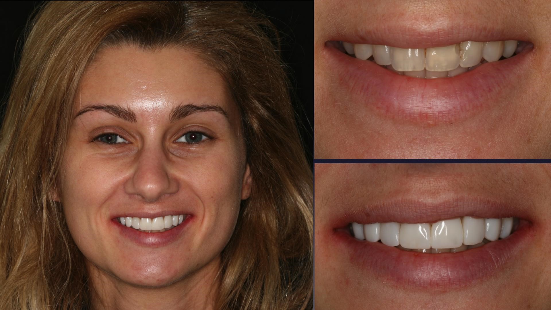 Best Cosmetic Dentist In Chicago