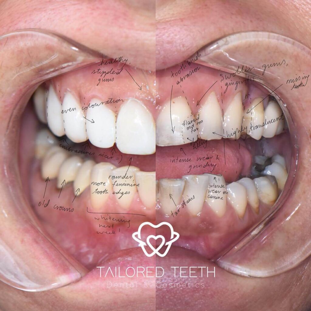 Cosmetic Dental Surgery