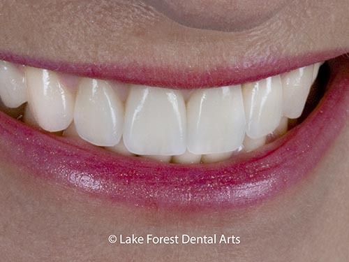 Cosmetic Dentist In Chicago Illinois Cosmetic Dentist In Chicago Illinois