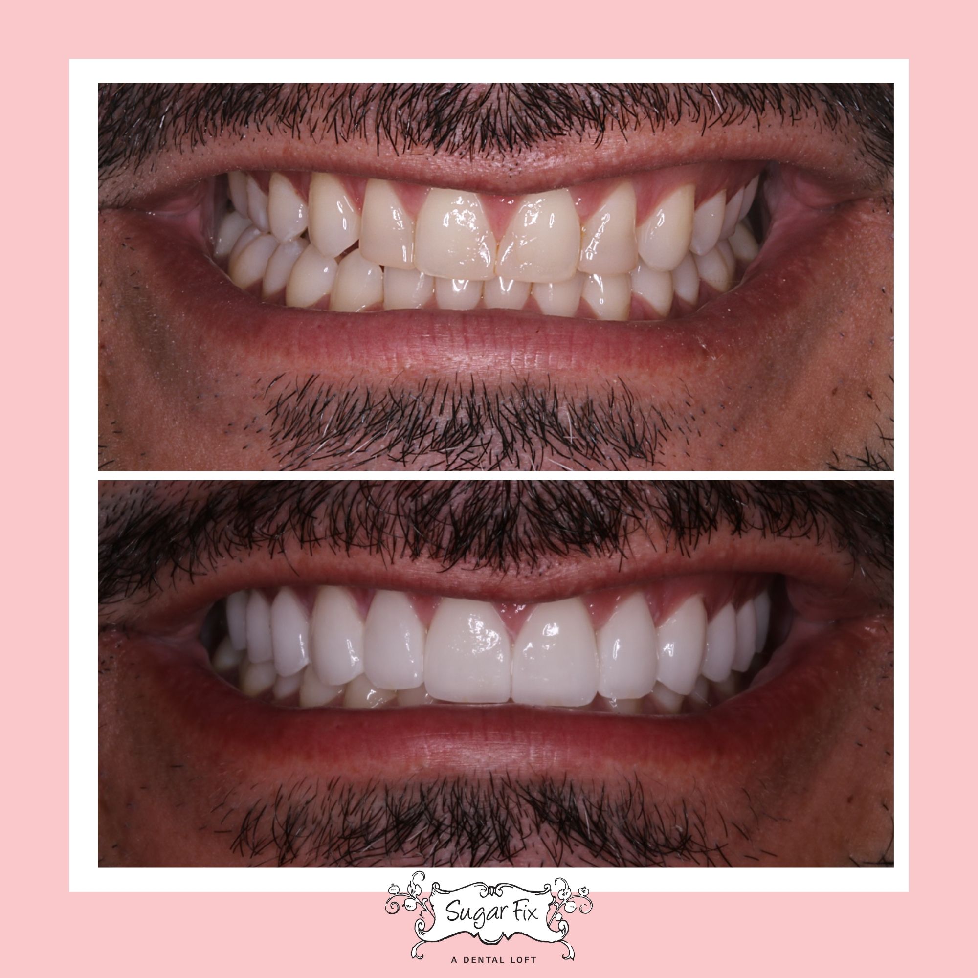 Cosmetic Dentist In Chicago Illinois Cosmetic Dentist In Chicago Illinois