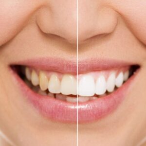 Cosmetic and Family Dentistry of Las Colinas