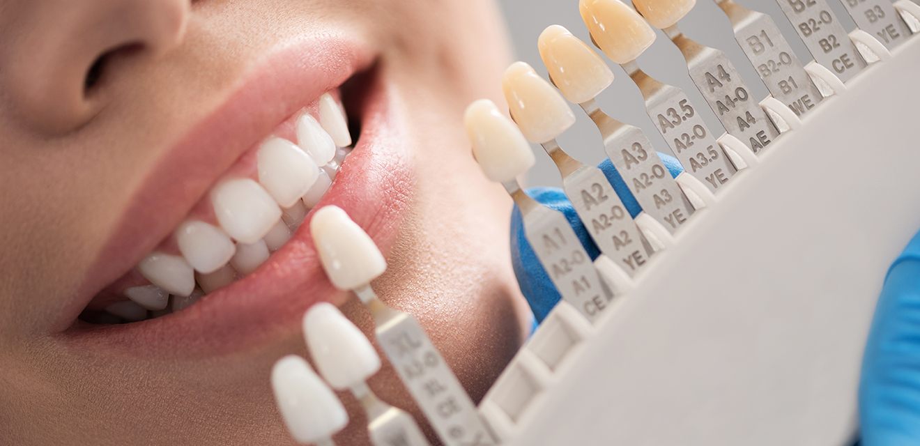 Cosmetic Dentist In Denver Colorado