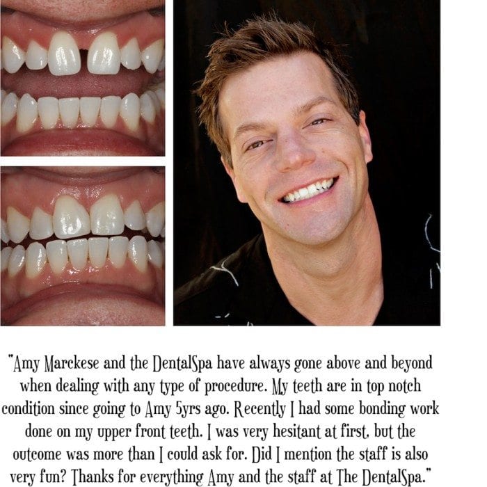 Cosmetic Dentist In Indianapolis Indiana Cosmetic Dentist In Indianapolis Indiana