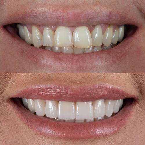 Cosmetic Dentist In Los Angeles California