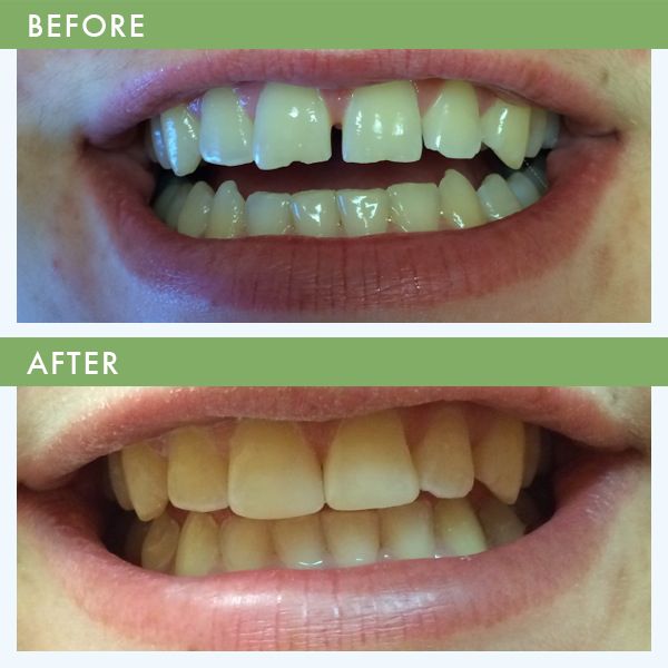 Cosmetic Dentist In Louisville Jefferson County Kentucky