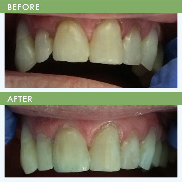Cosmetic Dentist In Louisville Jefferson County Kentucky