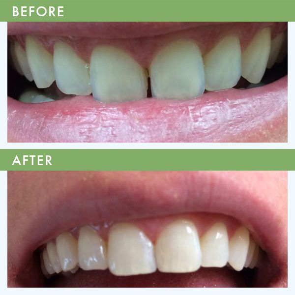 Cosmetic Dentist In Louisville Jefferson County Kentucky