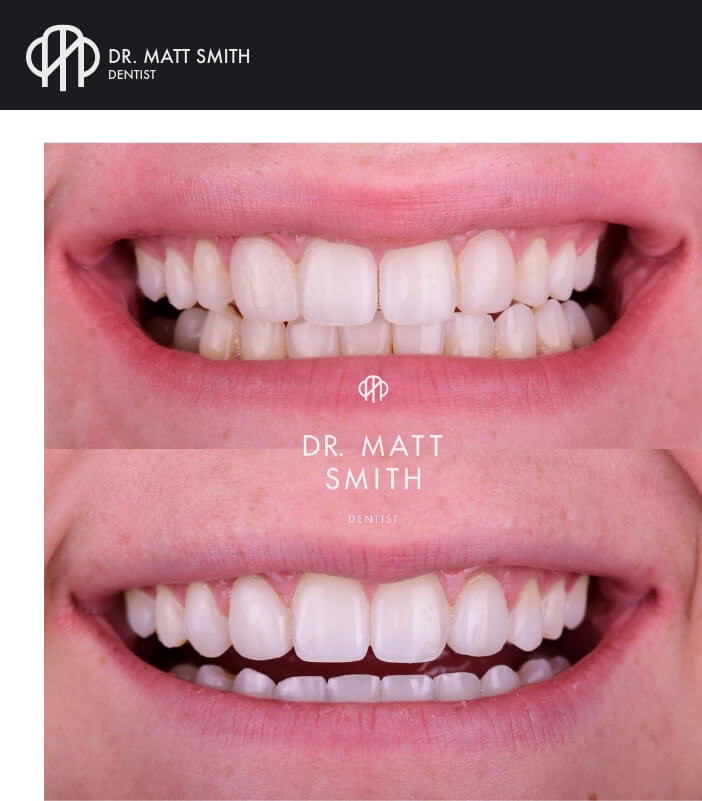 Cosmetic Dentist In Milwaukee Wisconsin