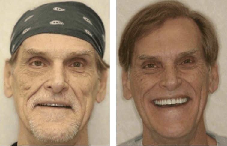 Cosmetic Dentist In Milwaukee Wisconsin