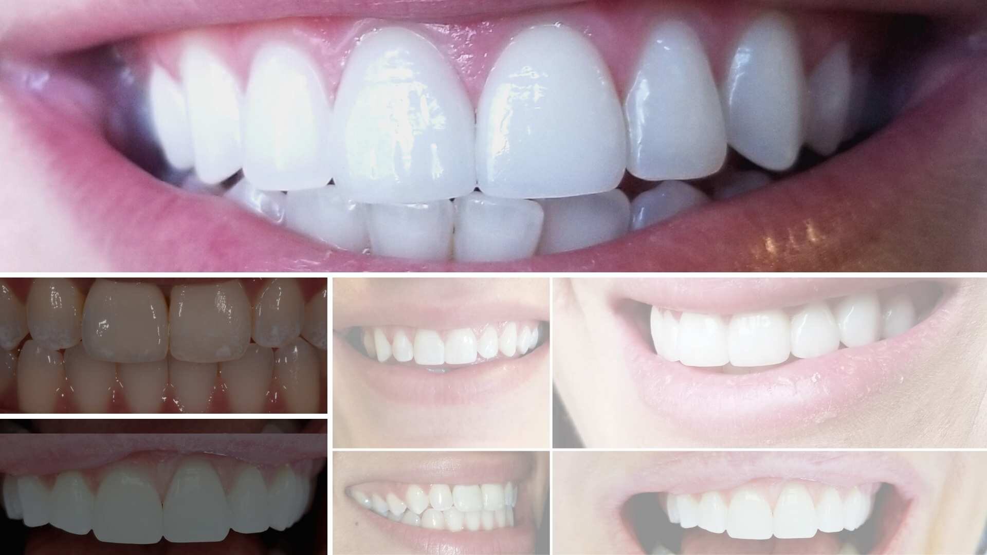 Cosmetic Dentist In Minneapolis Minnesota