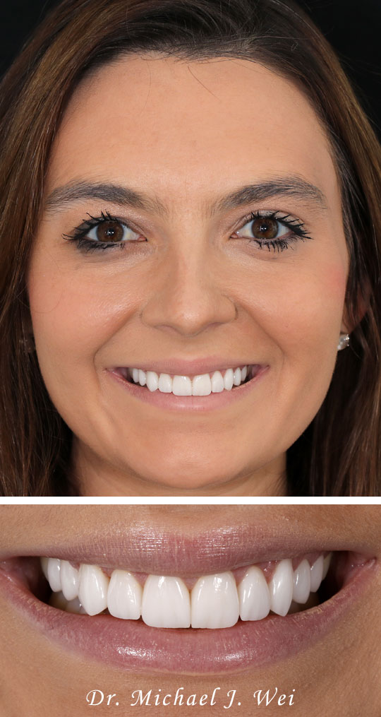 Cosmetic Dentist In New York New York