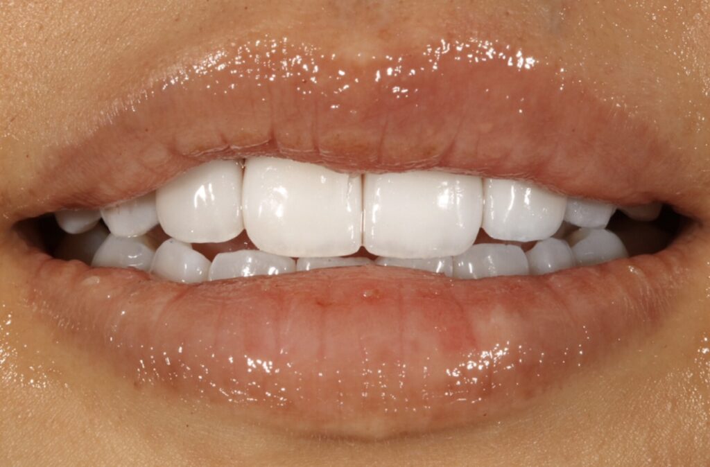 Best Cosmetic Dentist in Las Palmas San Antonio Texas 2 Best Cosmetic Dentist in Las Palmas San Antonio Texas