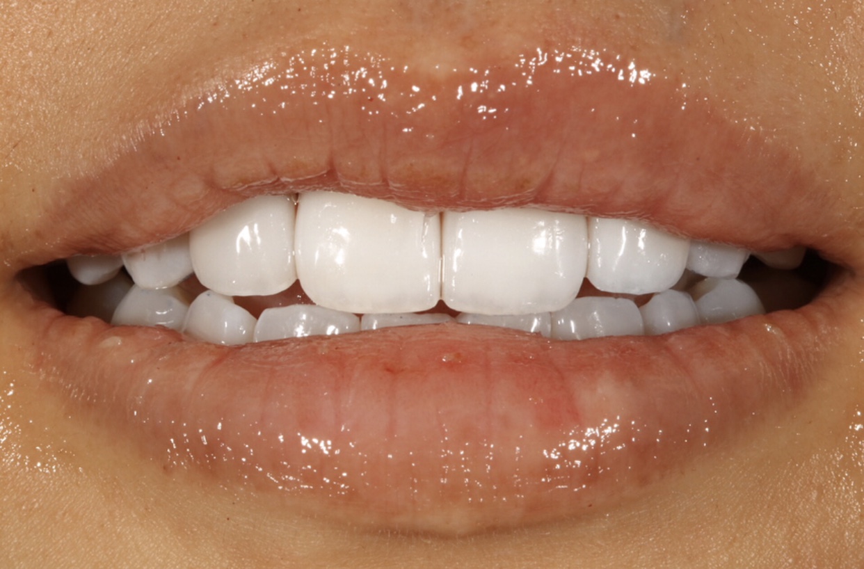 Cosmetic Dentist In San Francisco California