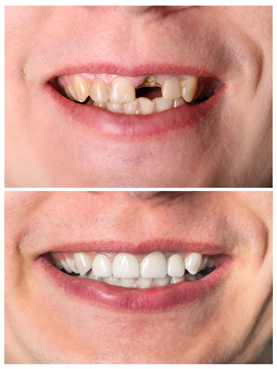 Cosmetic Dentist In Seattle Washington