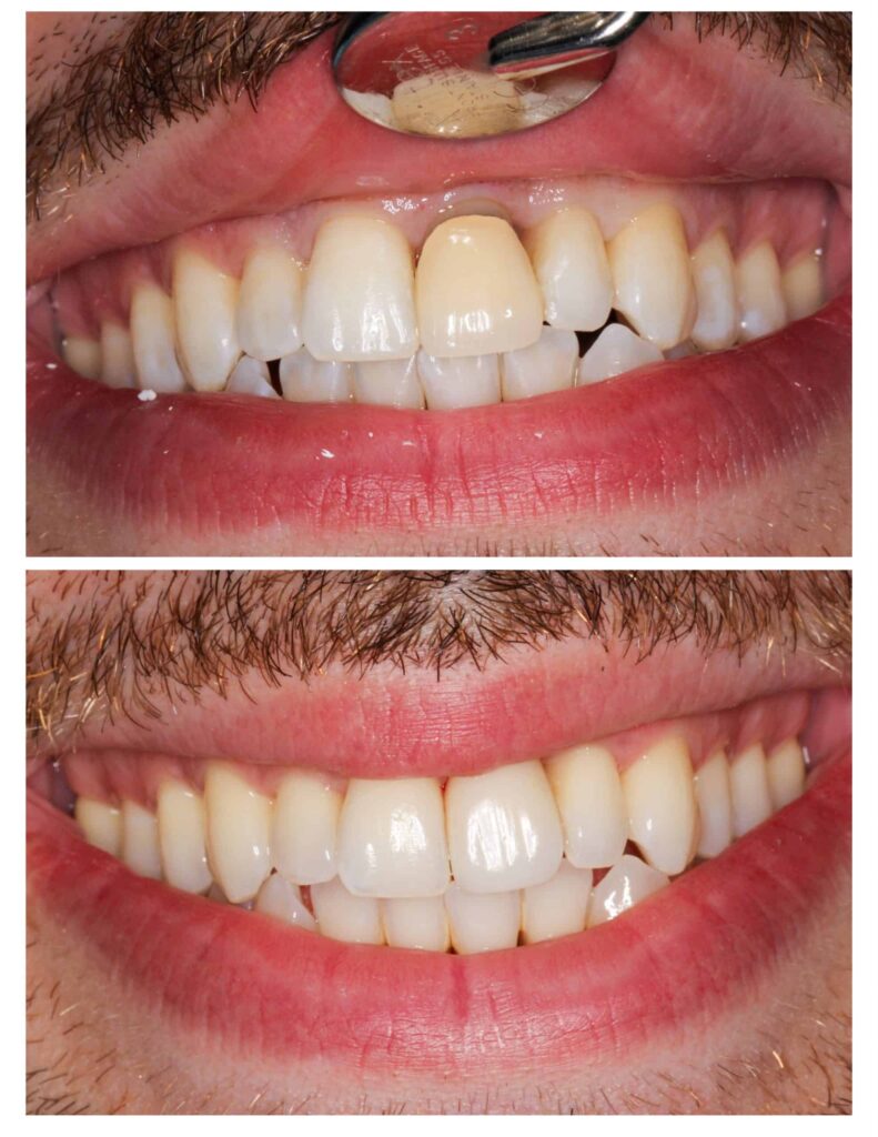 Cosmetic Dentist in Gilbert