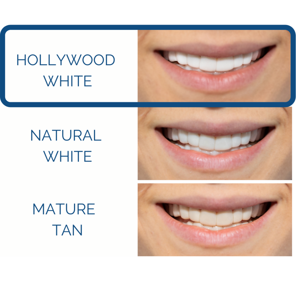 Pop On Veneers