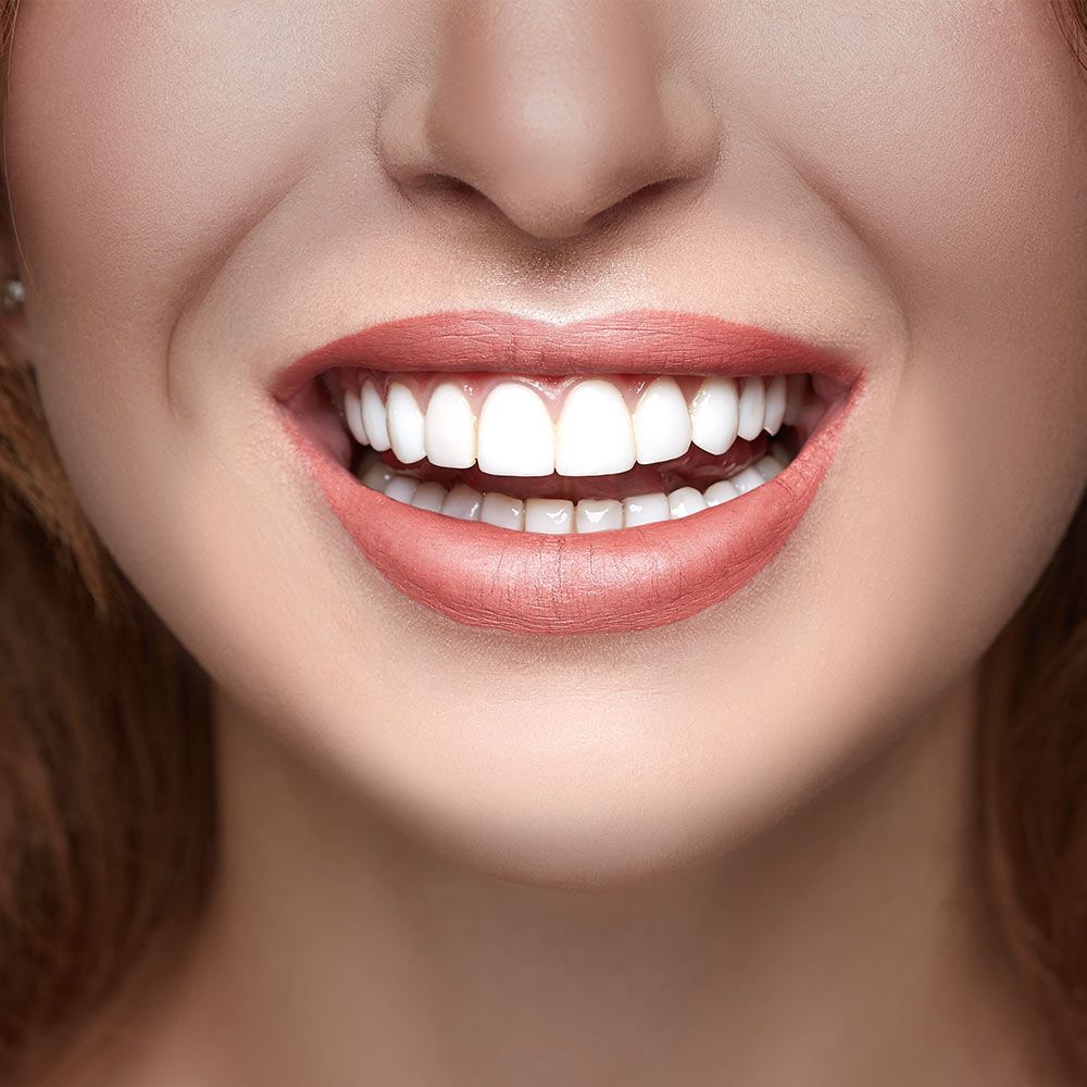 Porcelain Veneers Cost Porcelain Veneers Cost