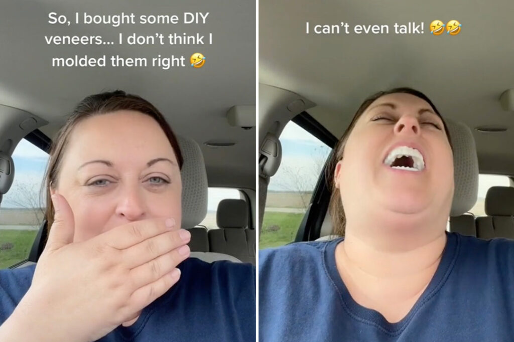 Veneers At Home