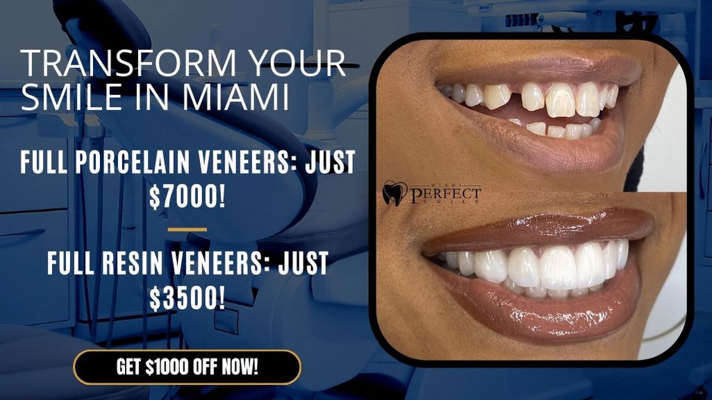 Veneers Cost Chicago Veneers Cost Chicago