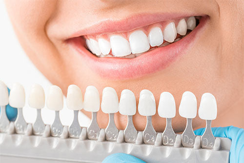 Veneers Teeth Price Veneers Teeth Price
