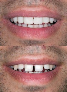 Affordable Cosmetic Dentistry Near Me