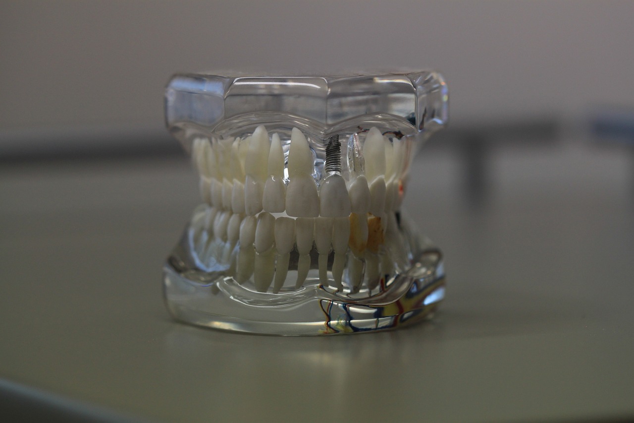 Cosmetic Dentist In Anchorage Alaska