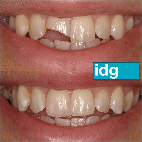 Cosmetic Dentist In Des Moines Iowa Cosmetic Dentist In Des Moines Iowa