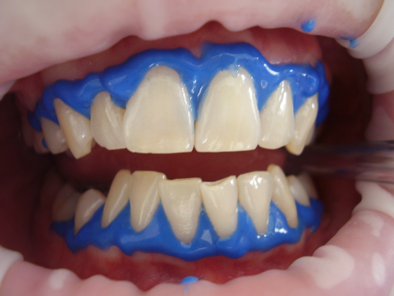 Cosmetic Dentist In Fontana California Cosmetic Dentist In Fontana California
