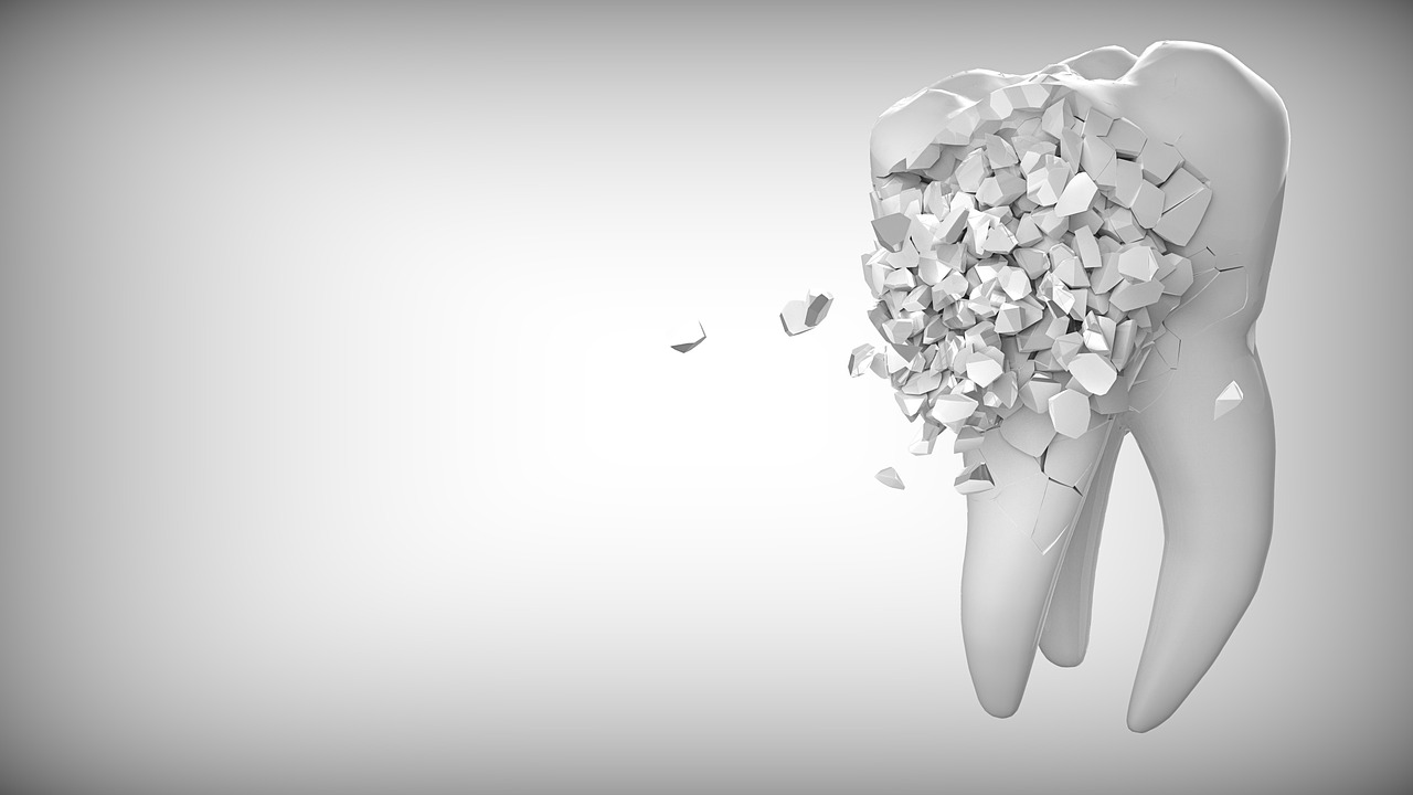 Cosmetic Dentist In Garland Texas Cosmetic Dentist In Garland Texas