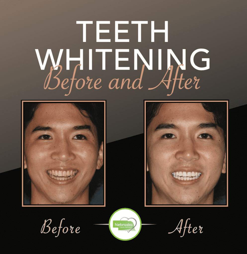 Cosmetic Dentist In Lincoln Nebraska