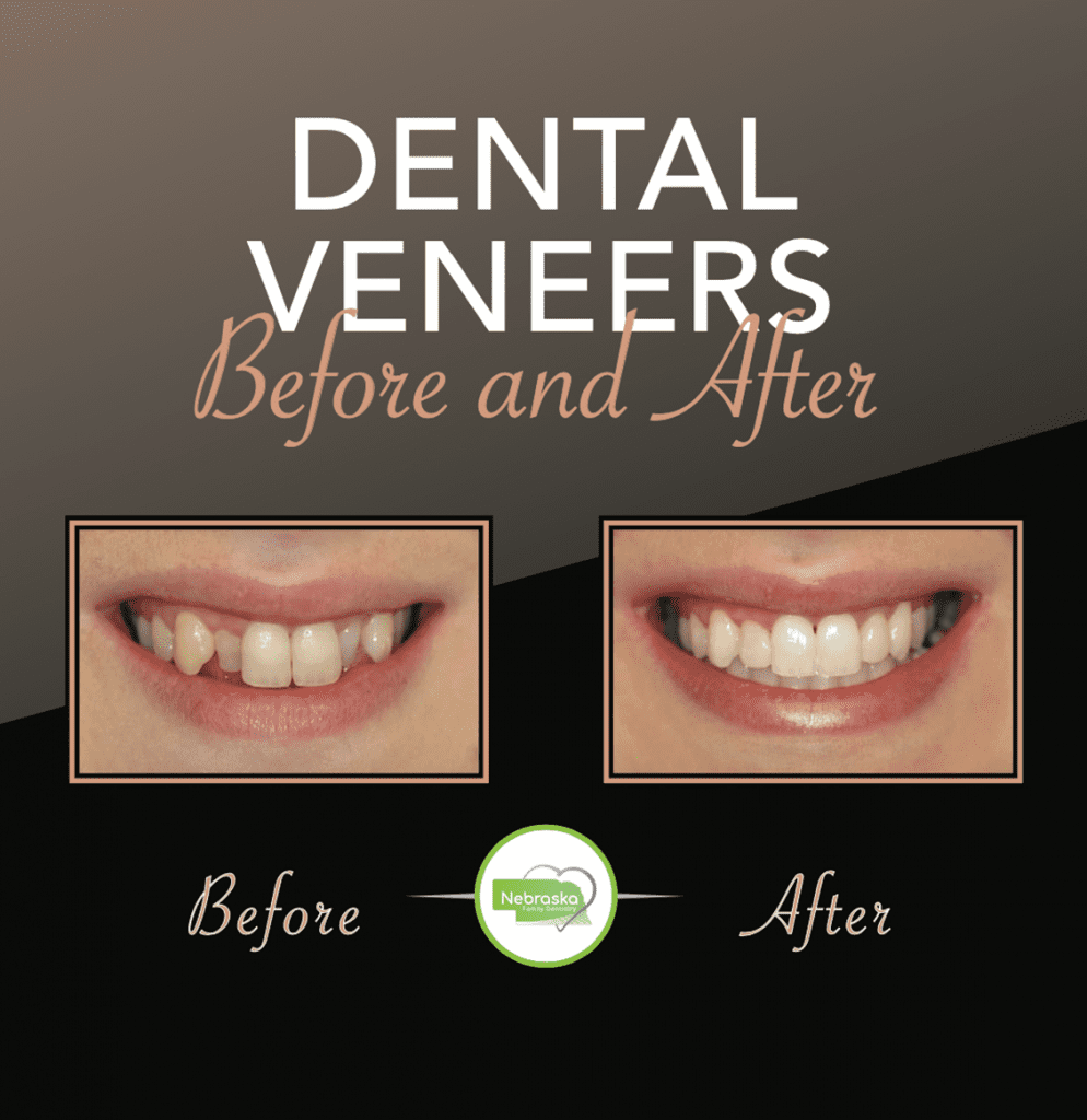 Cosmetic Dentist In Lincoln Nebraska