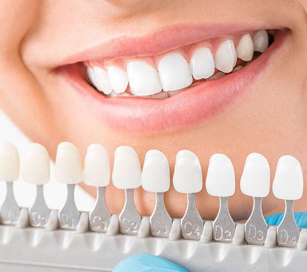 Cosmetic Dentist In Santa Clarita California