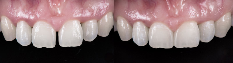 Find a Cosmetic Dentist in Appleton Find a Cosmetic Dentist in Appleton