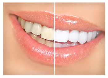 Find a Cosmetic Dentist in Daytona Beach, FL