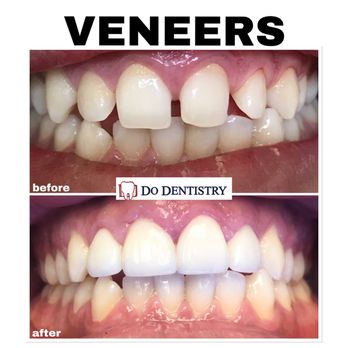Find a Cosmetic Dentist in Monterey Park, CA Find a Cosmetic Dentist in Monterey Park, CA