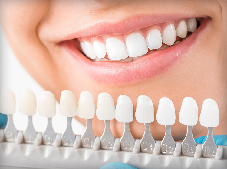 Find a Skilled Cosmetic Dentist in West Des Moines Find a Skilled Cosmetic Dentist in West Des Moines