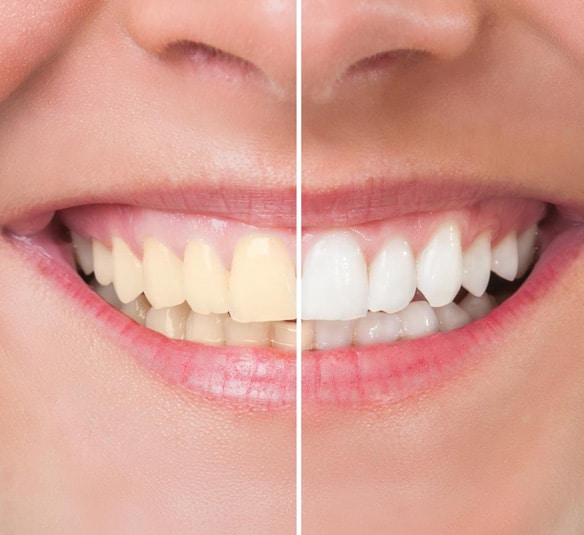 Find the Best Cosmetic Dentist in Beaverton Oregon Find the Best Cosmetic Dentist in Beaverton Oregon