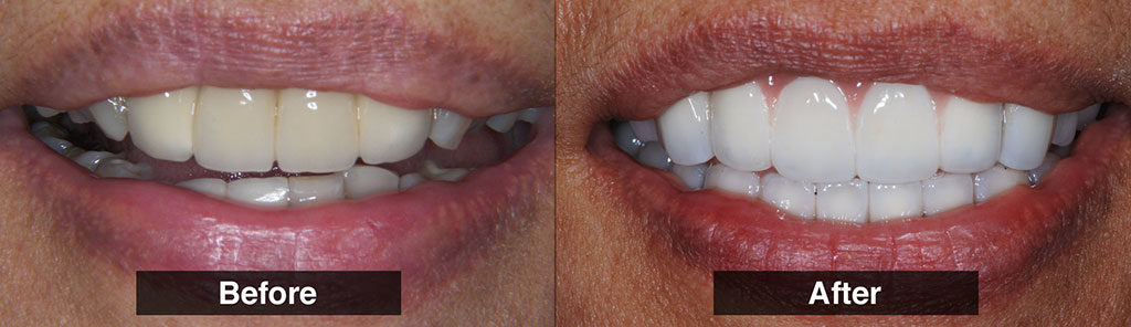 Find the Best Cosmetic Dentist in Sugar Land Find the Best Cosmetic Dentist in Sugar Land