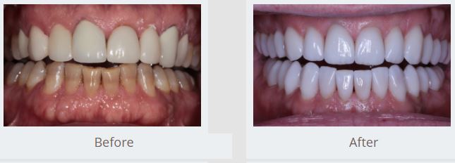 Find the Best Cosmetic Dentist in Sugar Land Find the Best Cosmetic Dentist in Sugar Land