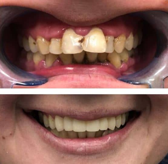 Find the Best Cosmetic Dentist in Sugar Land Find the Best Cosmetic Dentist in Sugar Land