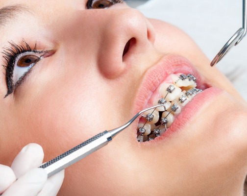 Orthodontics Chicago