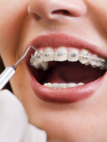 Orthodontics Chicago