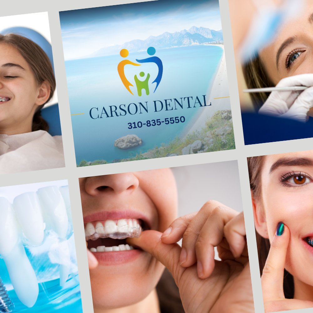 The Best Cosmetic Dentist in Carson California
