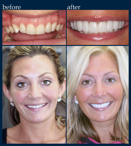 Top Cosmetic Dentist in Albany