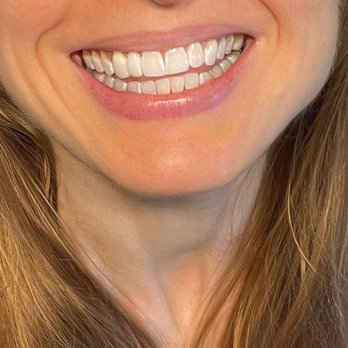 Top Cosmetic Dentist in Albany