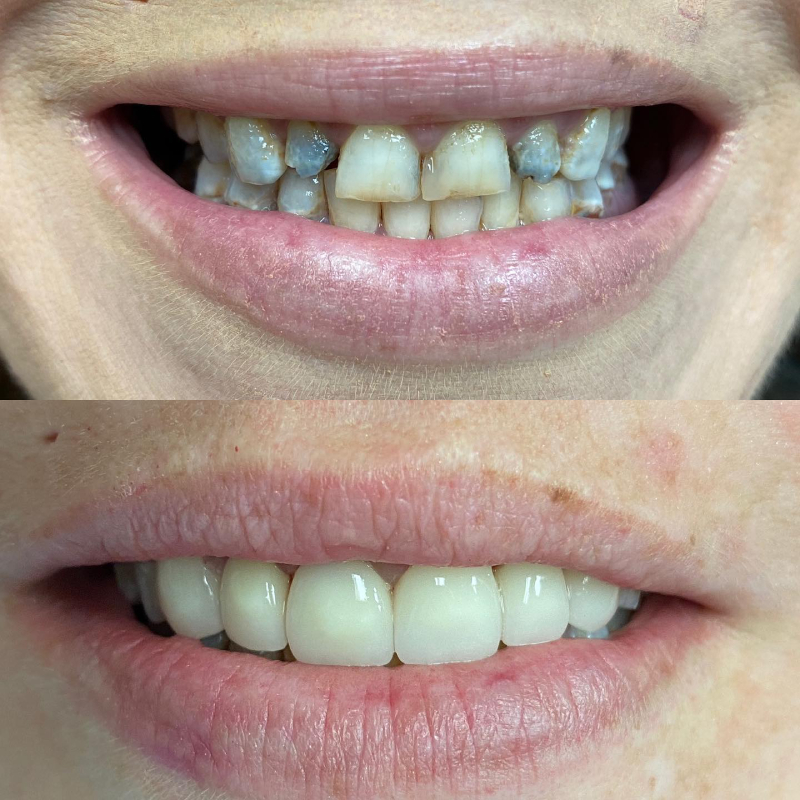 Top Cosmetic Dentist in El Cajon Top Cosmetic Dentist in El Cajon