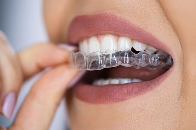 Top Cosmetic Dentist in Largo, FL