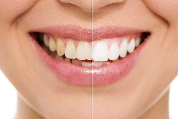 Top Cosmetic Dentist in North Richland Hills Texas Top Cosmetic Dentist in North Richland Hills Texas